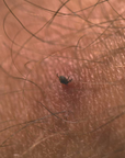Lifesystems Tick Remover Card little tick